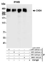 CHD4 Antibody in Immunoprecipitation (IP)