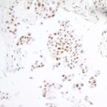 BRD3 Antibody in Immunohistochemistry (Paraffin) (IHC (P))