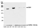 ZEB1 Antibody in Western Blot (WB)