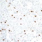 CEACAM8 Antibody in Immunohistochemistry (Paraffin) (IHC (P))