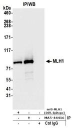 MLH1 Antibody in Immunoprecipitation (IP)