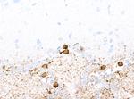 Tyrosine Hydroxylase Antibody in Immunohistochemistry (Paraffin) (IHC (P))