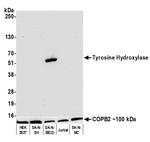 Tyrosine Hydroxylase Antibody in Western Blot (WB)