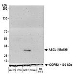 MASH1 Antibody in Western Blot (WB)