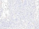 H3.3 G34R oncohistone mutant Antibody in Immunohistochemistry (IHC)