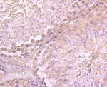 gamma Tubulin Antibody in Immunohistochemistry (Paraffin) (IHC (P))
