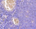 Cyclin A2 Antibody in Immunohistochemistry (Paraffin) (IHC (P))