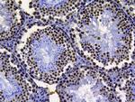 Histone H3 Antibody in Immunohistochemistry (Paraffin) (IHC (P))