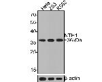 NTHL1 Antibody in Western Blot (WB)