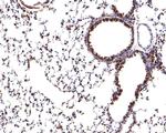 RPS8 Antibody in Immunohistochemistry (Paraffin) (IHC (P))
