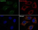 NUDT19 Antibody in Immunocytochemistry (ICC/IF)