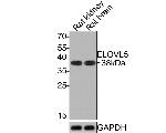 ELOVL5 Antibody in Western Blot (WB)