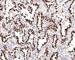 Nkx2.1 Antibody in Immunohistochemistry (Paraffin) (IHC (P))