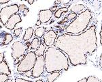 Nkx2.1 Antibody in Immunohistochemistry (Paraffin) (IHC (P))