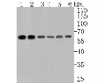 ELP3 Antibody in Western Blot (WB)