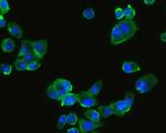 HLA-DMB Antibody in Immunocytochemistry (ICC/IF)