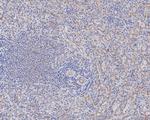 CD84 Antibody in Immunohistochemistry (Paraffin) (IHC (P))