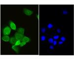 RCL Antibody in Immunocytochemistry (ICC/IF)