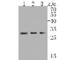 SNRPA1 Antibody in Western Blot (WB)