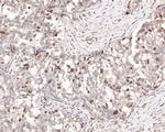 TOP2A Antibody in Immunohistochemistry (Paraffin) (IHC (P))