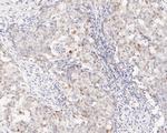 Phospho-STAT5 alpha (Tyr694) Antibody in Immunohistochemistry (Paraffin) (IHC (P))