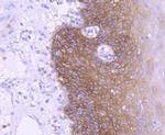 EGFR Antibody in Immunohistochemistry (Paraffin) (IHC (P))