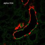 alpha-ENaC Antibody in Immunohistochemistry (Paraffin) (IHC (P))