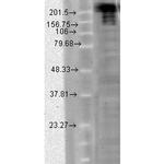 SCN9A Antibody in Western Blot (WB)