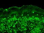 CACNB2 Antibody in Immunohistochemistry (Paraffin) (IHC (P))