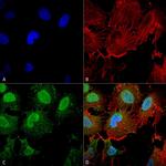 mGluR1/mGluR5 Antibody in Immunocytochemistry (ICC/IF)