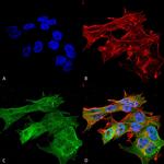 Versican Antibody in Immunocytochemistry (ICC/IF)