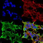 GluR1 Antibody in Immunocytochemistry (ICC/IF)