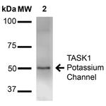 KCNK3 Antibody in Western Blot (WB)