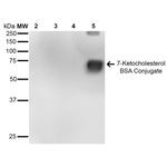 7-Ketocholesterol Antibody in Western Blot (WB)