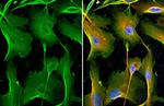 MMP1 Antibody in Immunocytochemistry (ICC/IF)