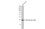 Acetyl-SOD2 (Lys68) Antibody in Western Blot (WB)