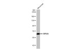 RPE65 Antibody in Western Blot (WB)