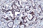 TRIM28 Antibody in Immunohistochemistry (Paraffin) (IHC (P))