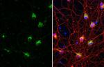 IP3 Receptor 1 Antibody in Immunocytochemistry (ICC/IF)