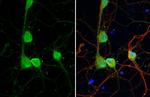 DRD2 Antibody in Immunocytochemistry (ICC/IF)