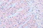 DRD2 Antibody in Immunohistochemistry (Paraffin) (IHC (P))