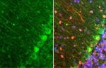 DRD2 Antibody in Immunohistochemistry (Paraffin) (IHC (P))