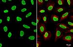 hnRNP A2B1 Antibody in Immunocytochemistry (ICC/IF)