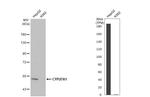 CYP27A1 Antibody in Western Blot (WB)