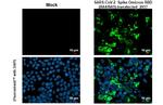 SARS-CoV-2 Spike Protein RBD Omicron Antibody in Immunocytochemistry (ICC/IF)