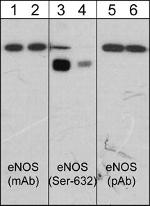 Phospho-eNOS (Ser632) Antibody in Western Blot (WB)