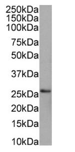 PRDX4 Antibody in Western Blot (WB)