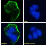 Lewis Y Antibody in Immunocytochemistry (ICC/IF)