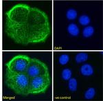 MUC1 Chimeric Antibody in Immunocytochemistry (ICC/IF)