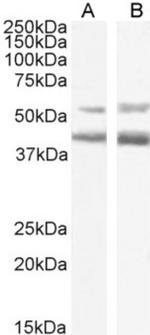 Mogamulizumab Chimeric Antibody in Western Blot (WB)